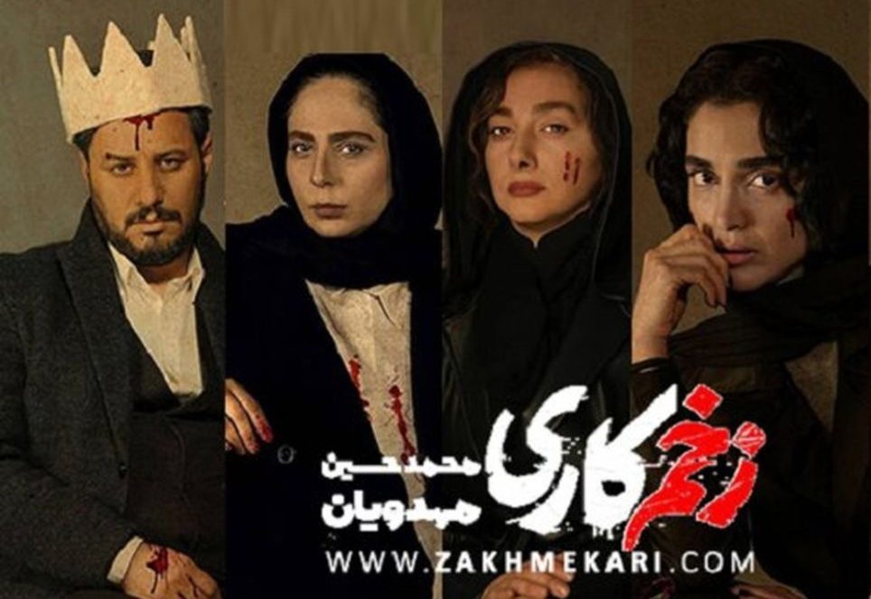 عکس های دیده نشده از خانم بازیگران زخم کاری در ترکیه! - تصویر شاخص