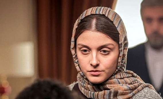 تیپ هالیوودی خانم بازیگرِ زخم کاری کنار برج ایفل - تصویر شاخص