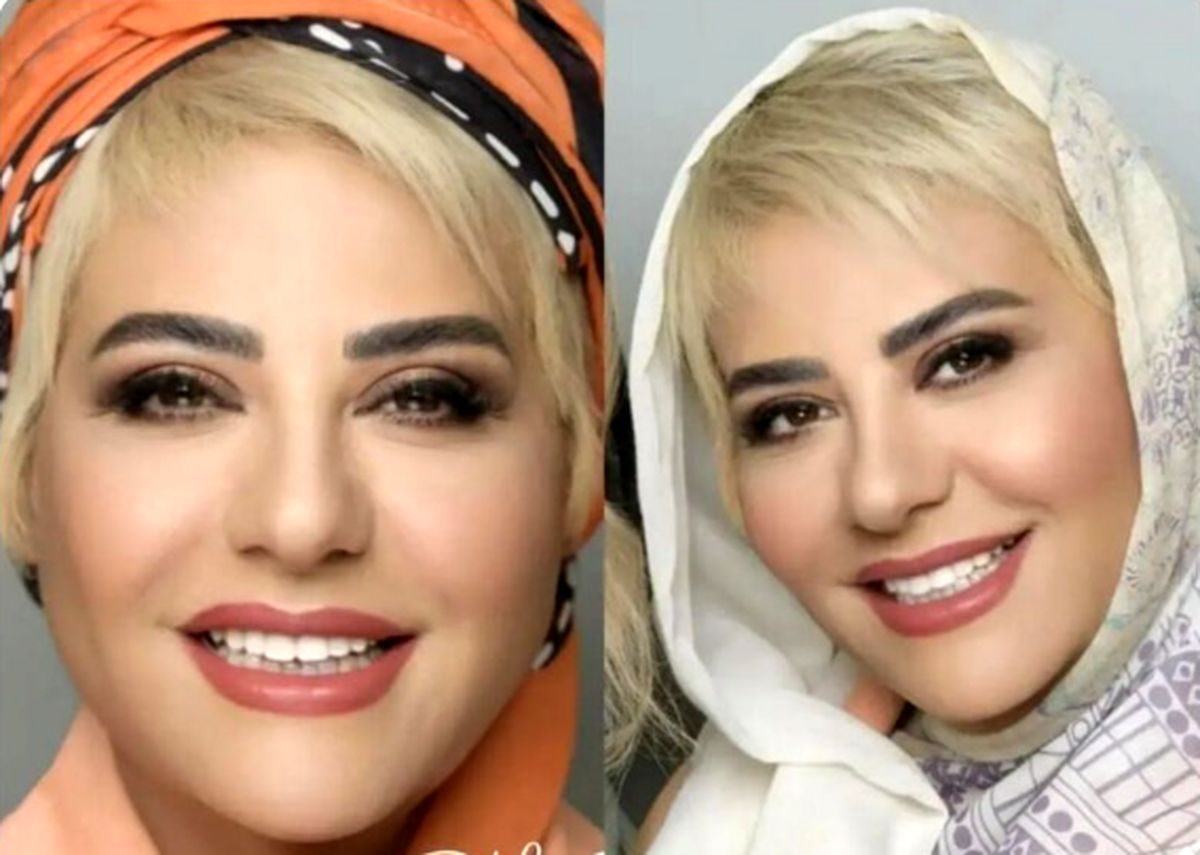 سیر تا پیاز زندگی رابعه اسکویی ؛ از ماجرای مهاجرت تا دلخوری از مازیار لرستانی - تصویر شاخص
