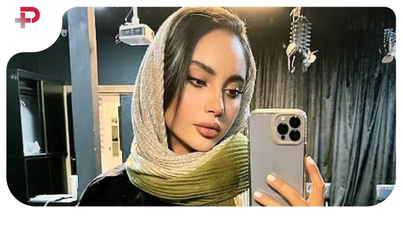تغییر چهره فوق جذاب ترلان پروانه در عکس جدیدش+ بیوگرافی خودش و همسرش و همه عمل های زیبایی اش