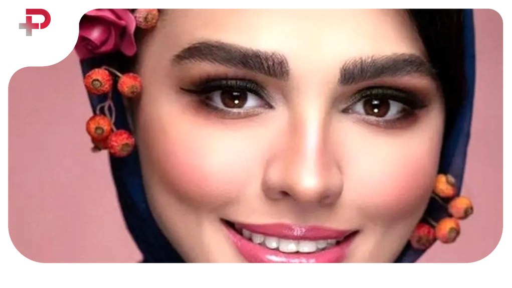 سیما خضرآبادی