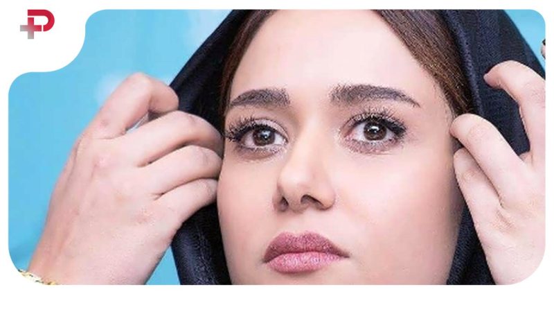 عکس| بدل ترکیه‌ای پریناز ایزدیار را دیده اید؟/  همسر مشهور بوراک اوزچویت