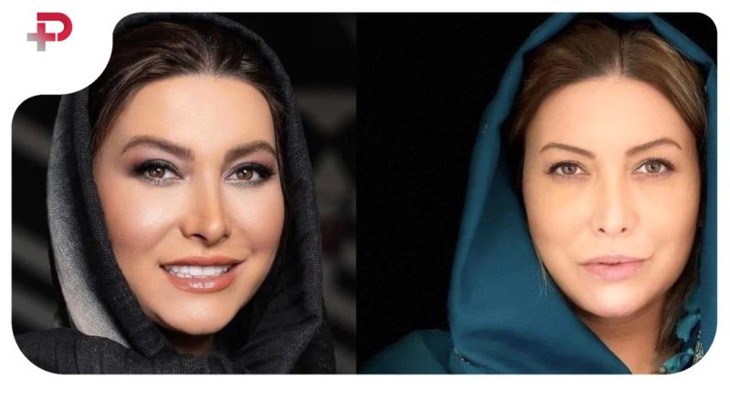 سیر تا پیاز زندگی مسعود رسام شوهر اول فریبا نادری + تصاویر شخصی و دردآور