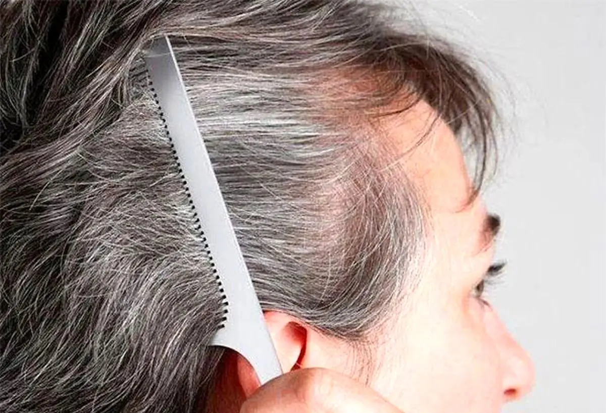 راهکارهای خانگی کاهش سفیدی مو/ چگونه از شر موهای سفید خلاص شویم - تصویر شاخص