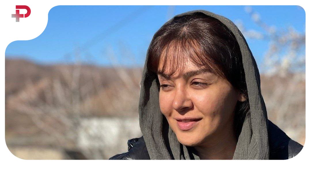 استایل عجیب و جالب ندا قاسمی؛ شلوار گورخری خانم بازیگر جلب توجه کرد - تصویر شاخص
