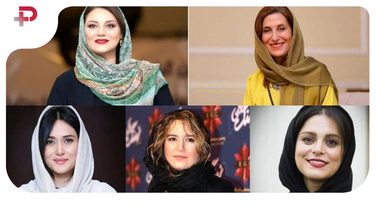 زیباترین بازیگران زن انتخاب شدند؛ رتبه اول برای چه کسی است؟ - تصویر شاخص