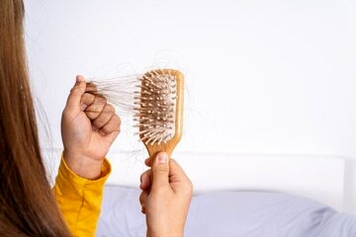 تنها کمی استرس کافی است تا ریزش مو آغاز شود - تصویر شاخص