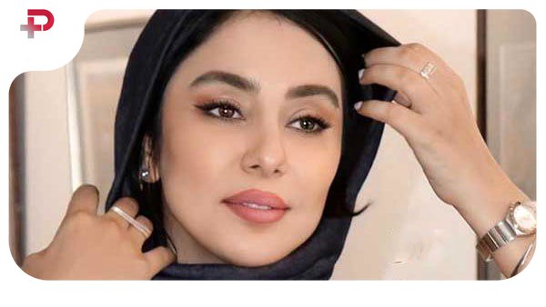 استایل شیک شیدا یوسفی بازیگر سریال بامداد خمار در دبی - تصویر شاخص