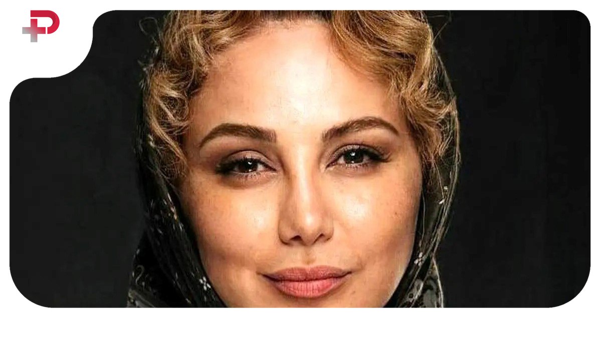 تغییر چهره باورنکردنی بهنوش بختیاری با عمل‌های زیبایی - تصویر شاخص