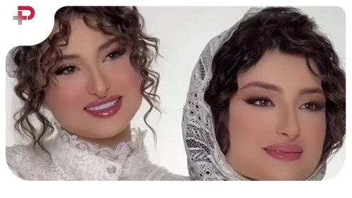 عکس| چهره ناراحت نیکا فرقانی اصل؛ روسری جذاب بازیگر پایتخت جلب توجه کرد - تصویر شاخص