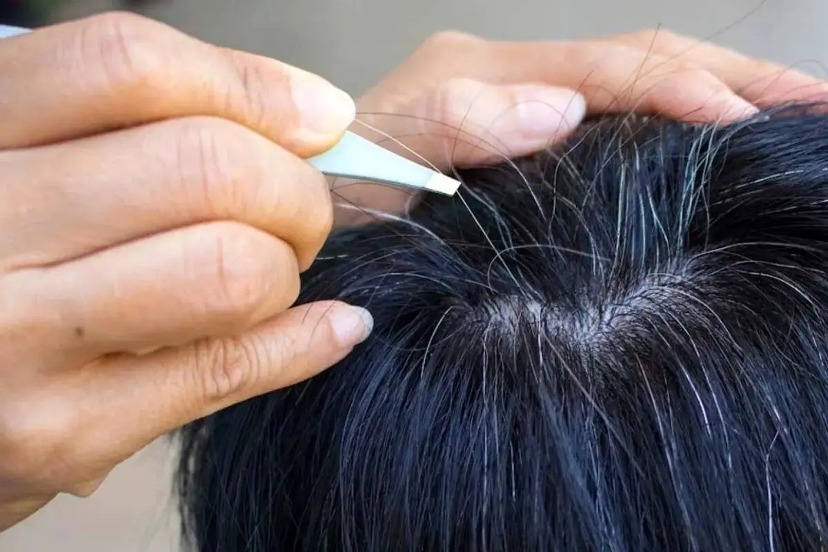 طب سنتی در مورد علت سفیدی مو چه می‌گوید؟ - تصویر شاخص