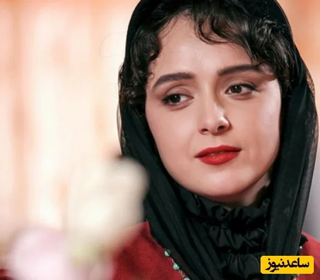 ترانه علیدوستی و نبرد سخت با بیماری نادر که زیبایی‌اش را تهدید کرد! - تصویر شاخص