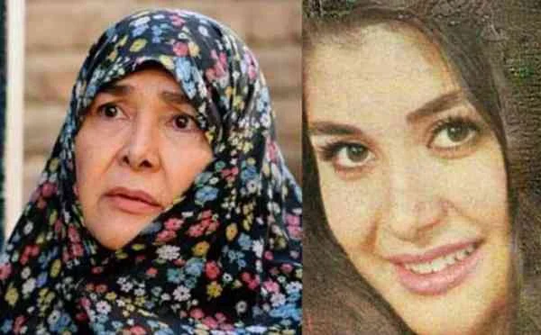 آفرین عبیسی قبل از عمل بینی