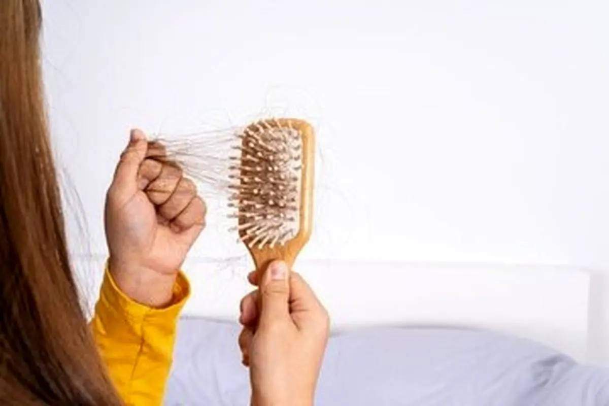 اگر این ۵ خوراکی در رژیم تان است، منتظر کچلی باشید - تصویر شاخص