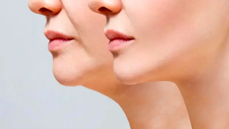 کدام ویتامین حیاتی باعث لاغری ناخواسته صورت میشود؟