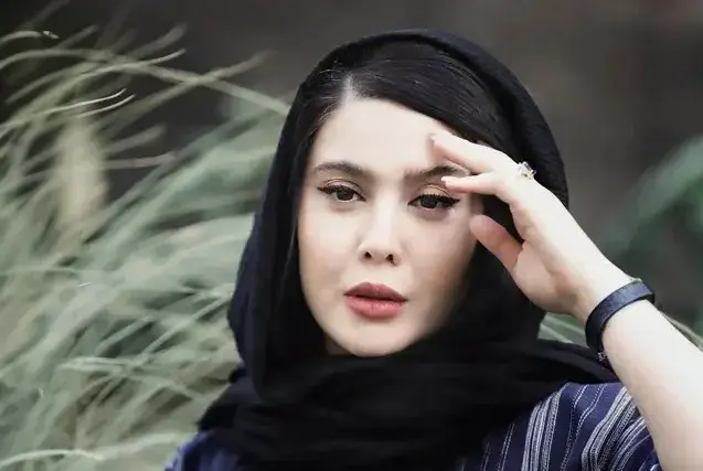نازنین کریمی تغییر چهره داد؛ خانم بازیگر با عمل زیبایی شناسایی نمیشه - تصویر شاخص