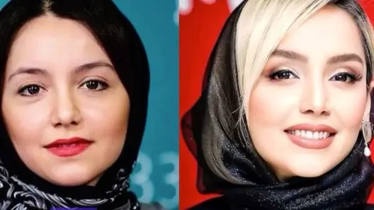 عکس| تغییرات چهره نازنین بیاتی از گذشته تا امروز؛ خام بازیگر محبوب دقیقا چه جراحی‌هایی انجام داده؟