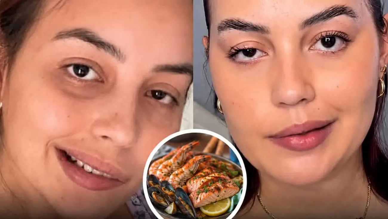 خوردن این غذا باعث فلج صورت زن جوان شد / چه علائمی دارد؟ - تصویر شاخص